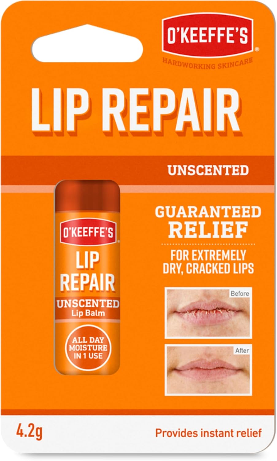 Lips